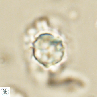 Heliolithus knoxii 69416