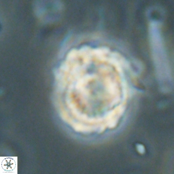 Heliolithus knoxii 69469