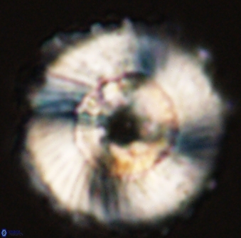 Heliolithus magnificus 56302