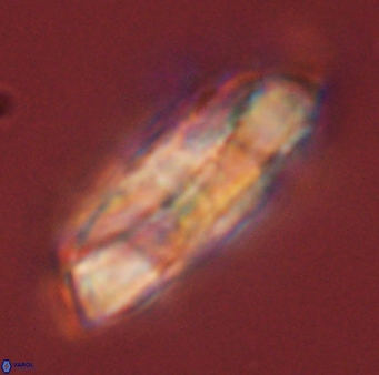 Heliolithus magnificus 56316