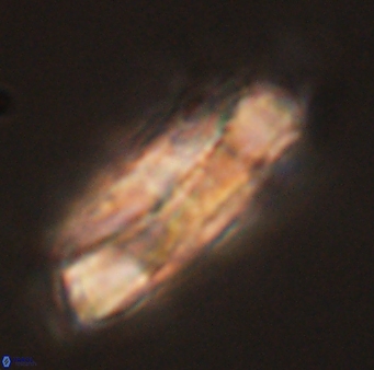 Heliolithus magnificus 56317