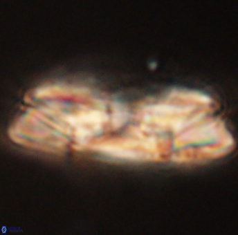 Heliolithus magnificus 56329