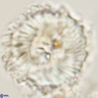 Heliolithus magnificus 57980