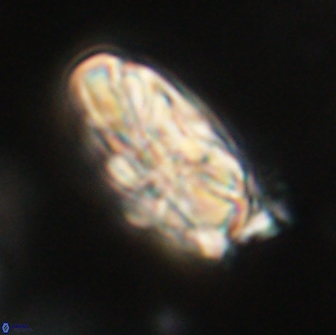 Heliolithus magnificus 65834