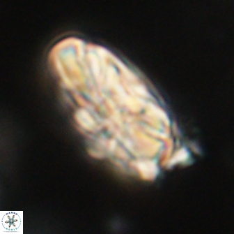 Heliolithus magnificus 65834
