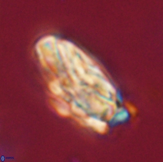 Heliolithus magnificus 65835