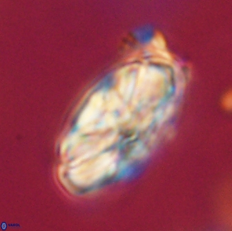 Heliolithus magnificus 65831