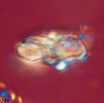 Heliolithus magnificus 65832