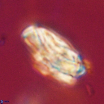 Heliolithus magnificus 57963