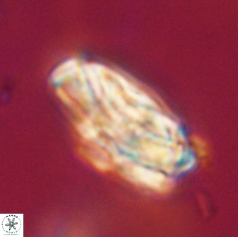 Heliolithus magnificus 65844