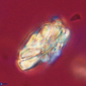 Heliolithus magnificus 65843