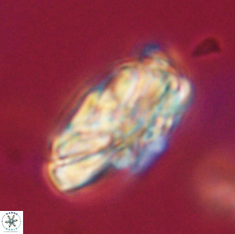 Heliolithus magnificus 65843