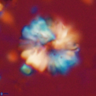 Heliolithus margarita 20900