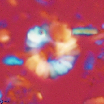 Heliolithus margarita 21106