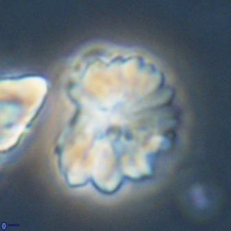 Heliolithus margarita 61140
