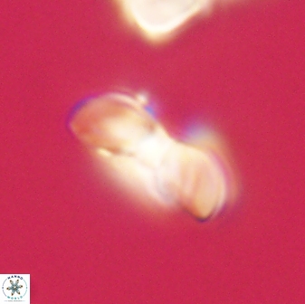 Heliolithus margarita 61145