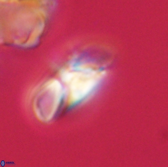 Heliolithus margarita 61156
