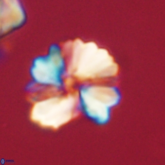 Heliolithus margarita 61163
