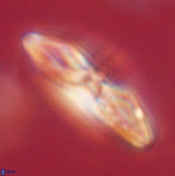 Heliolithus margarita 62484