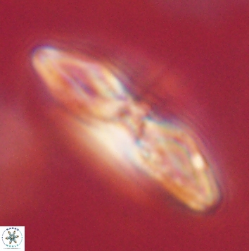 Heliolithus margarita 62484