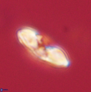 Heliolithus margarita 62163