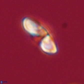 Heliolithus margarita 66722