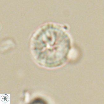 Heliolithus nefroeidis 66099