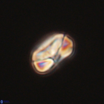 Heliolithus nefroeidis 66091