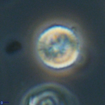 Heliolithus nefroeidis 66100