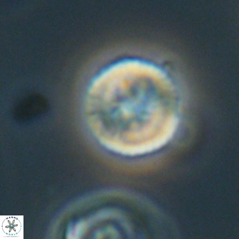 Heliolithus nefroeidis 66100