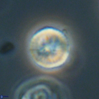 Heliolithus nefroeidis 66102