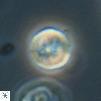 Heliolithus nefroeidis 66102
