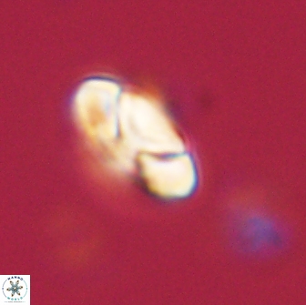 Heliolithus nefroeidis 66174