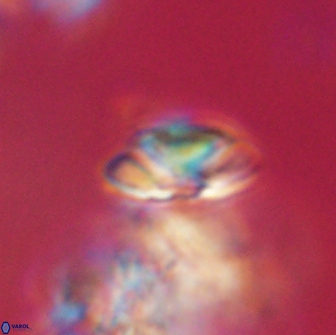 Heliolithus nefroeidis 66170