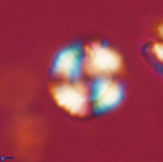 Heliolithus nefroeidis 66183