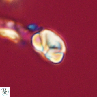 Heliolithus nefroeidis 66202