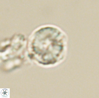Heliolithus nefroeidis 66217