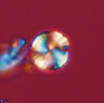 Heliolithus nefroeidis 66213