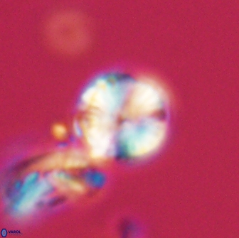 Heliolithus nefroeidis 66223