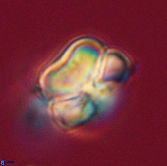 Heliolithus nefroeidis 66231