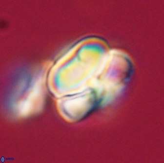 Heliolithus nefroeidis 66246