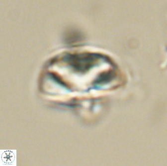 Heliolithus nefroeidis 66558