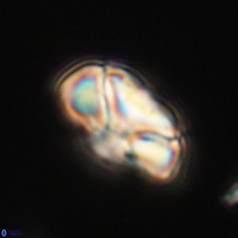 Heliolithus nefroeidis 66550