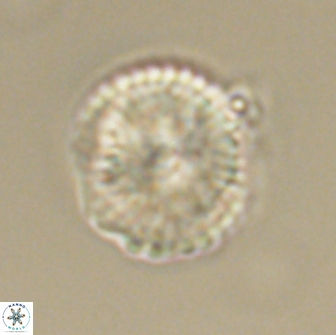 Heliolithus nefroeidis 66566