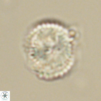 Heliolithus nefroeidis 66567