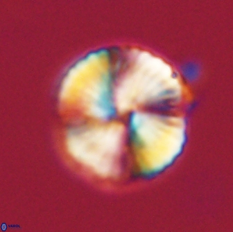 Heliolithus nefroeidis 66568