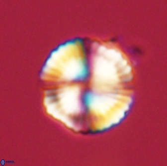 Heliolithus nefroeidis 66571