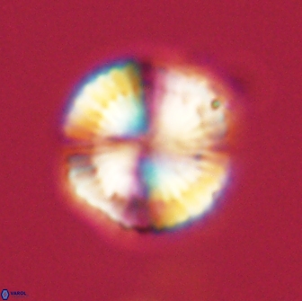 Heliolithus nefroeidis 66572