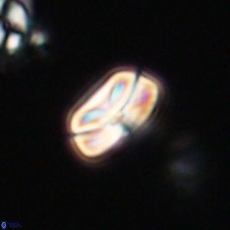 Heliolithus nefroeidis 66604