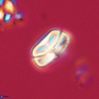 Heliolithus nefroeidis 66605